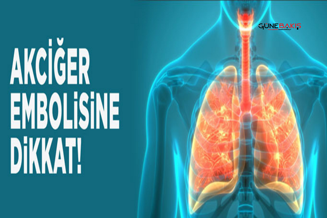 Akciğer embolisi riski taşıyor olabilirsiniz