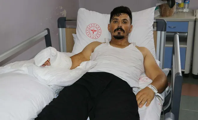 Kopan eli yerine dikilen işçi sağlığına kavuştu