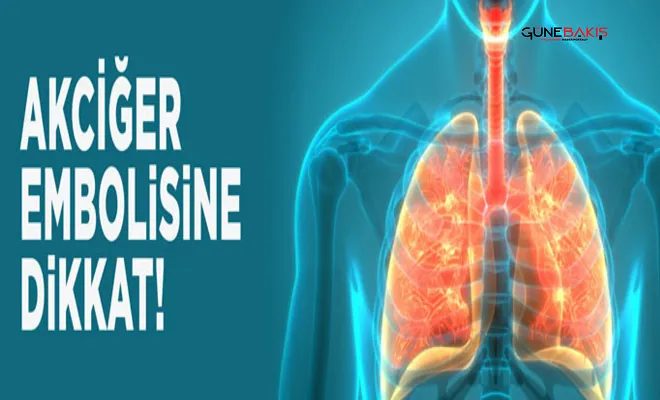 Akciğer embolisi riski taşıyor olabilirsiniz