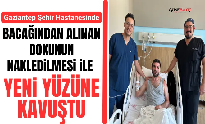 Gaziantep Şehir Hastanesinde bacağından alınan dokunun nakledilmesi ile yeni yüzüne kavuştu