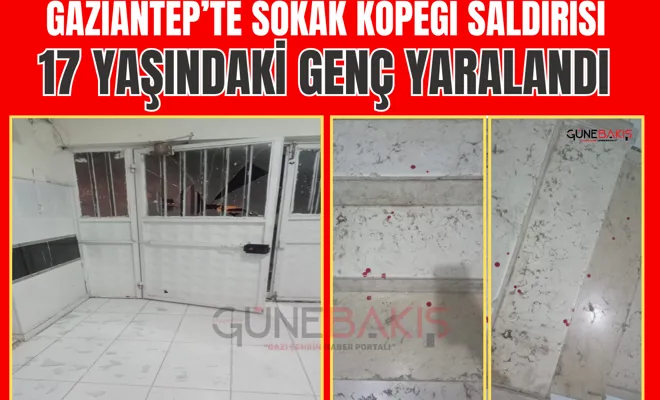 Gaziantep’te sokak köpeği saldırısı: 17 yaşındaki genç yaralandı