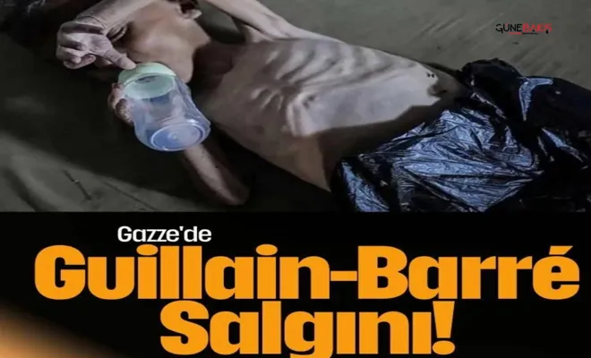 Gazze'de Guillain-Barré sendromu hızla yayılıyor!
