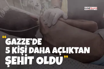 İşgalci İsrail’in Yemen’deki saldırılarında 35 şehit, 131 yaralı