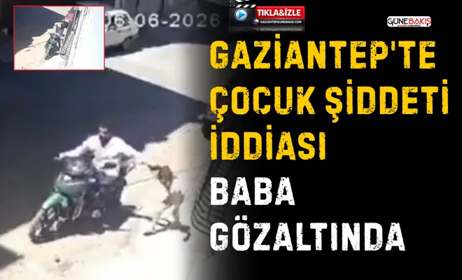 Gaziantep'te çocuk şiddeti iddiası: Baba gözaltında